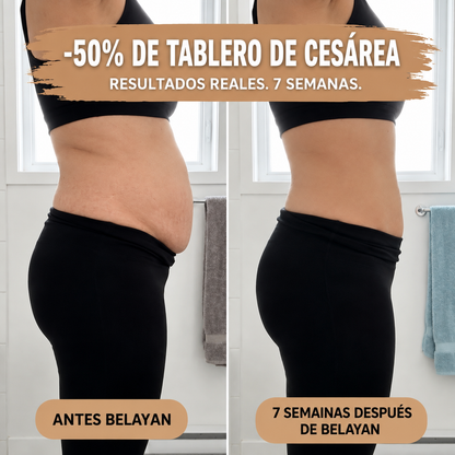Braga faja posparto — Compresión 360°